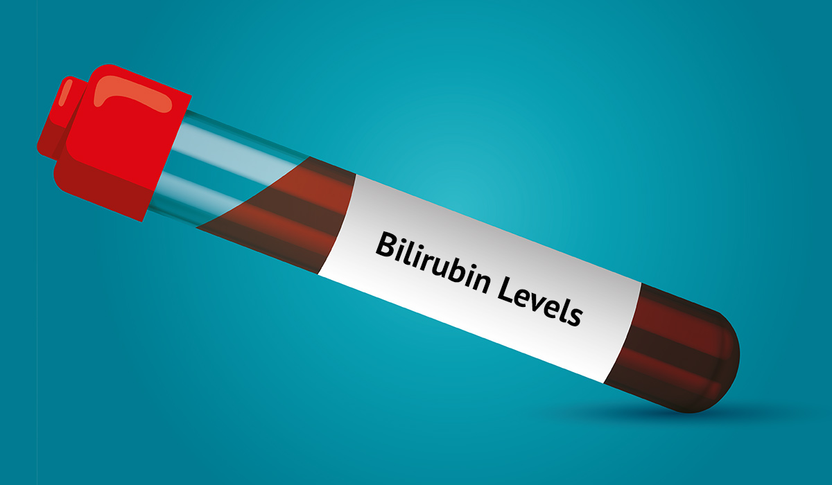 Bilirubin Levels