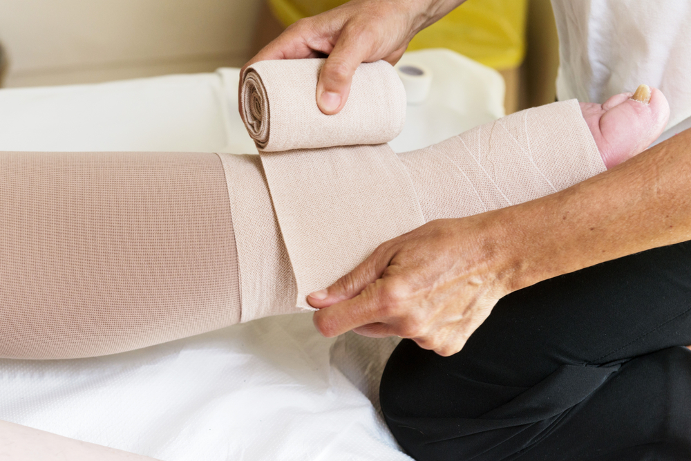 Bandages,Legs,And,Manual,Lymphatic,Drainage,Massage,For,A,Patient Bandages,Legs,And,Manual,Lymphatic,Drainage,Massage,For,A,Patient