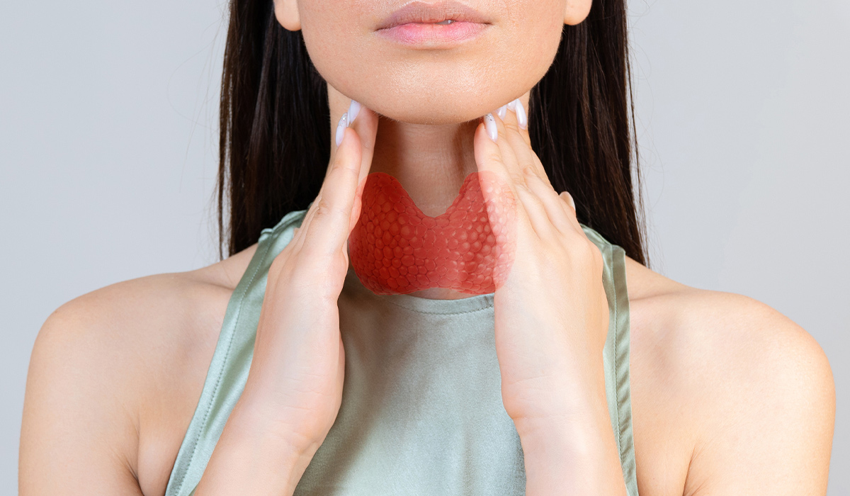 Hashimoto’s Disease