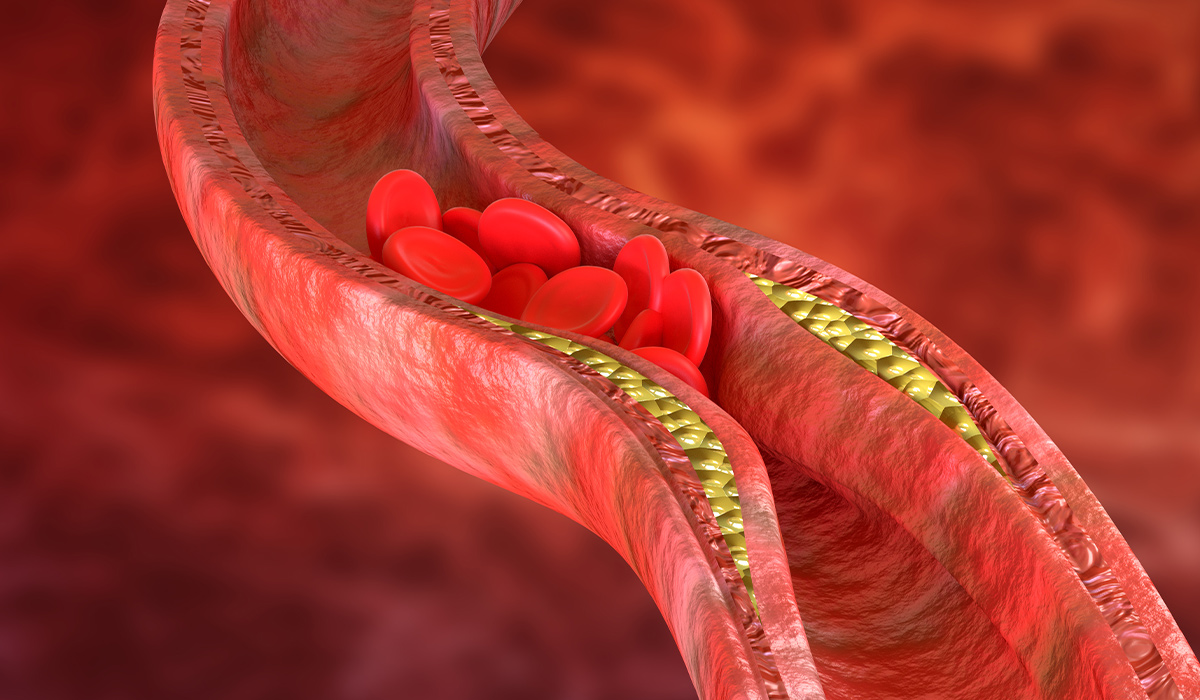 Cholesterol: How to Lower, Normal Levels, Functions, and Types