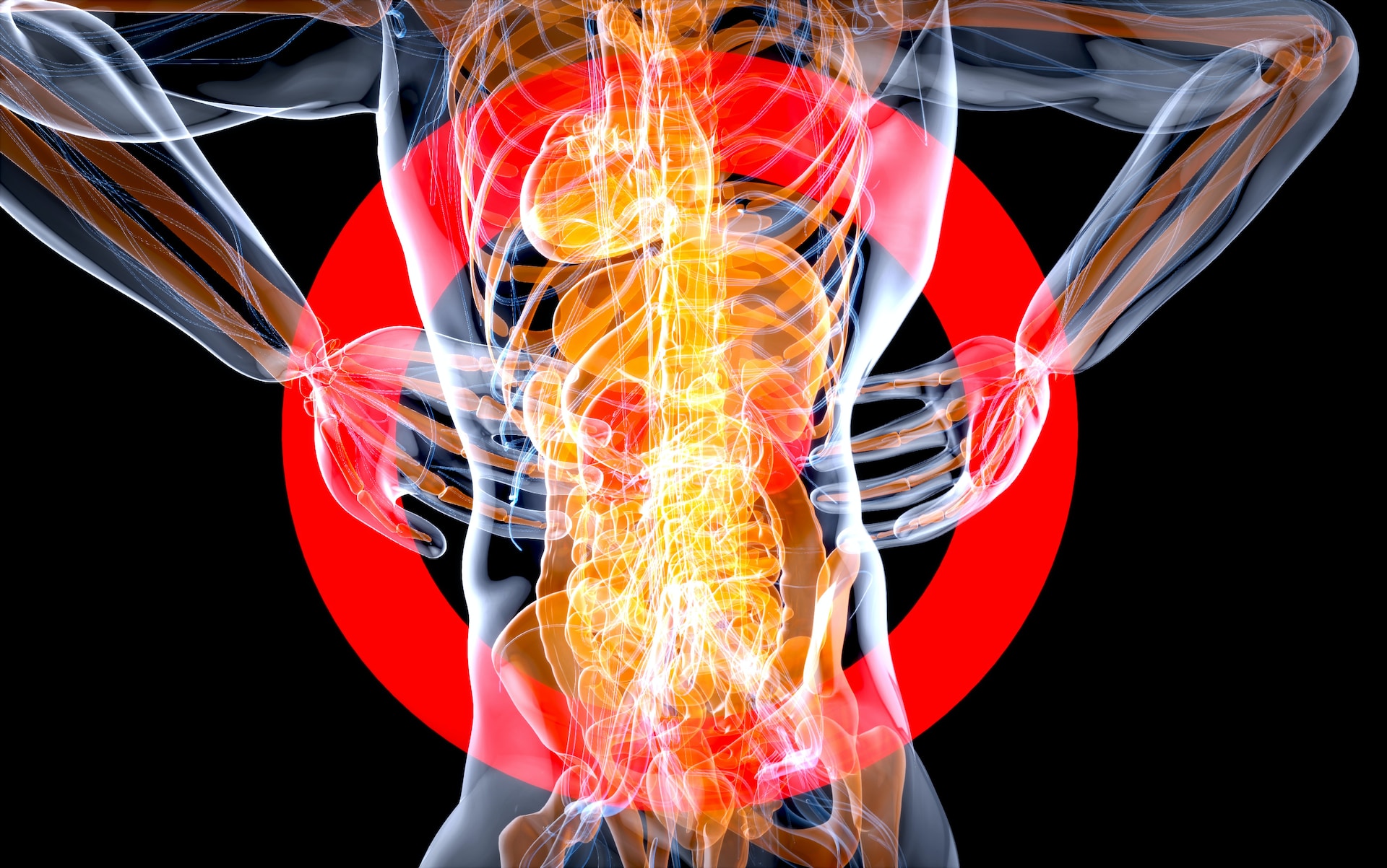 amyloidosis-926099