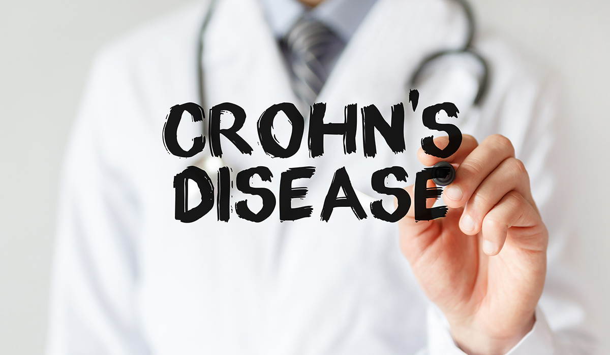 Crohn’s Disease