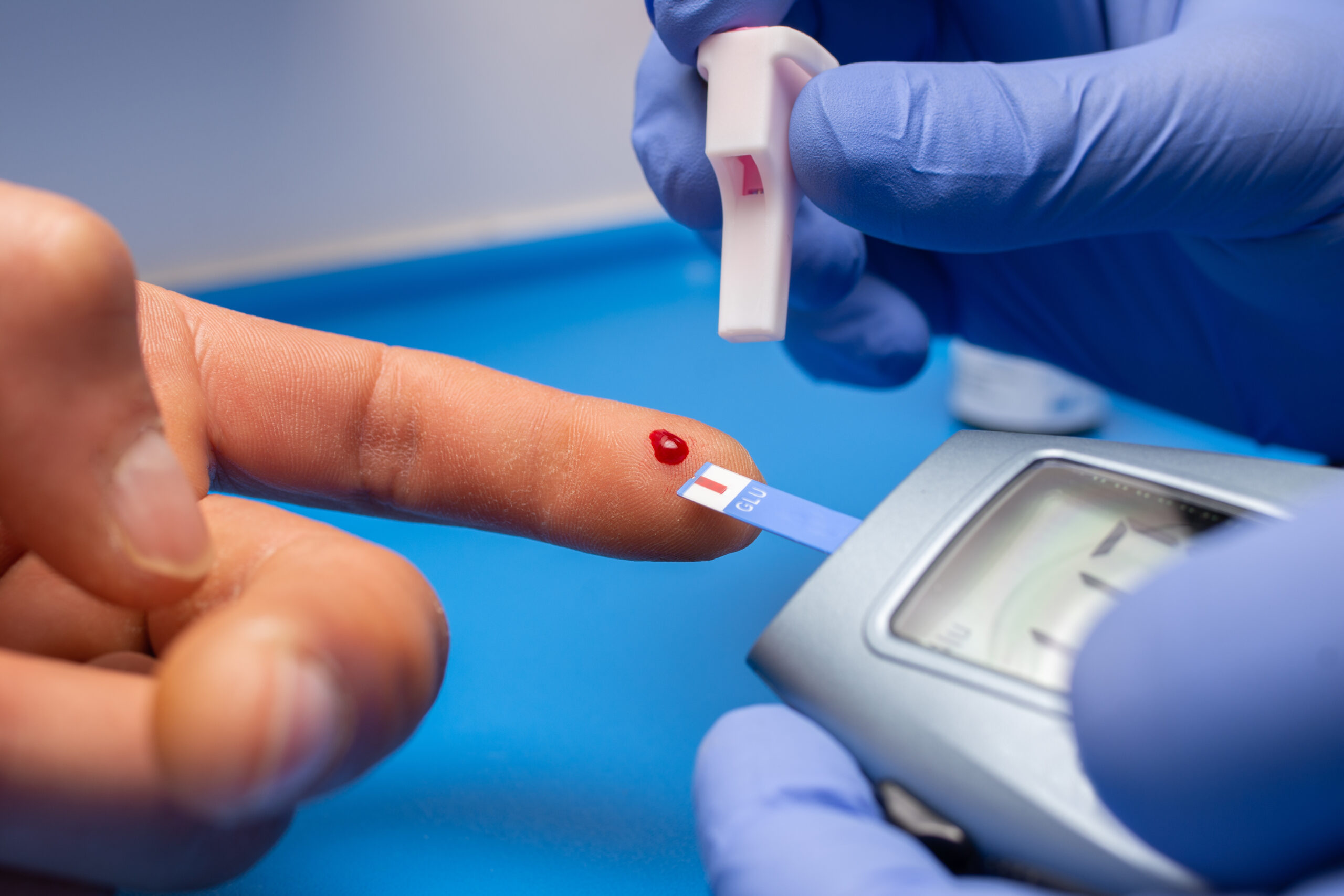 Closeup shot of a doctor with rubber gloves taking a blood test from a patient Closeup shot of a doctor with rubber gloves taking a blood test from a patient