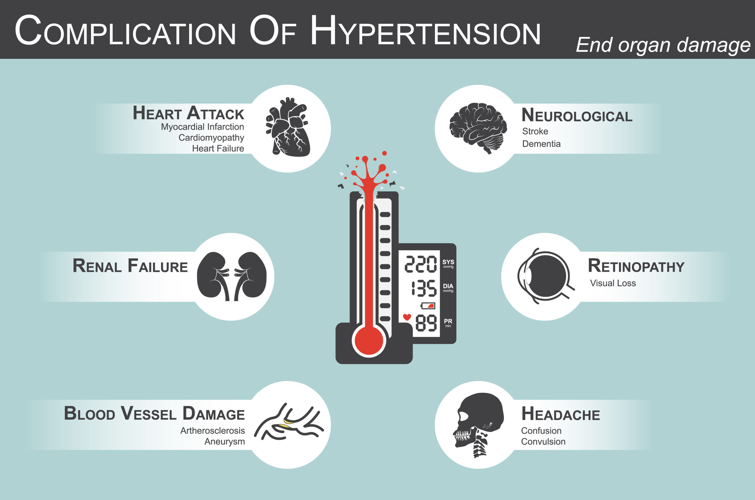 Complication,Of,Hypertension(heart,Attack,:,Myocardial,Infarction,,,Cardiomyopathy,)(brain Complication,Of,Hypertension(heart,Attack,:,Myocardial,Infarction,,,Cardiomyopathy,)(brain