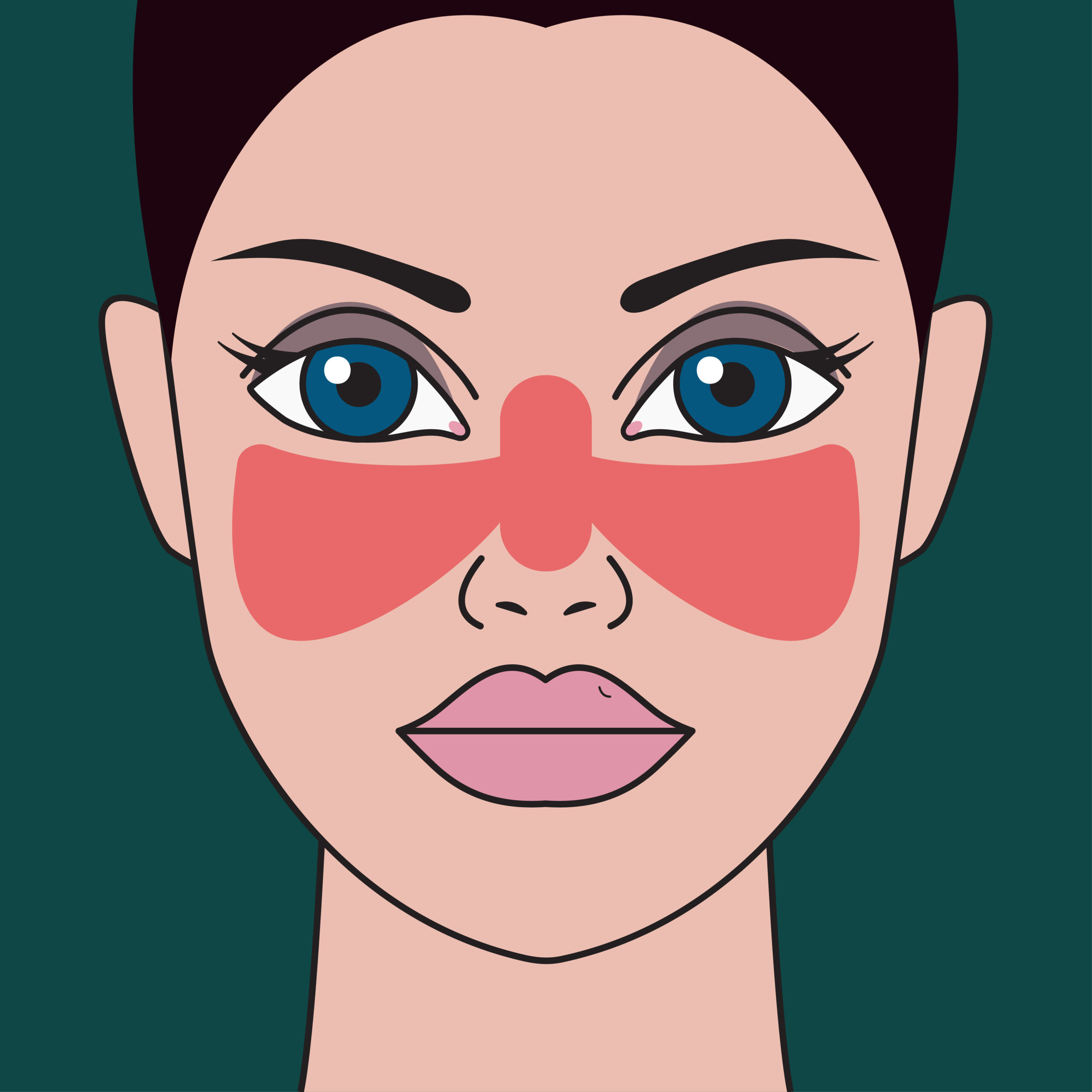 Systemic,Lupus,Erythematosus.,Woman,With,Red,Spot,On,Her,Face Systemic,Lupus,Erythematosus.,Woman,With,Red,Spot,On,Her,Face