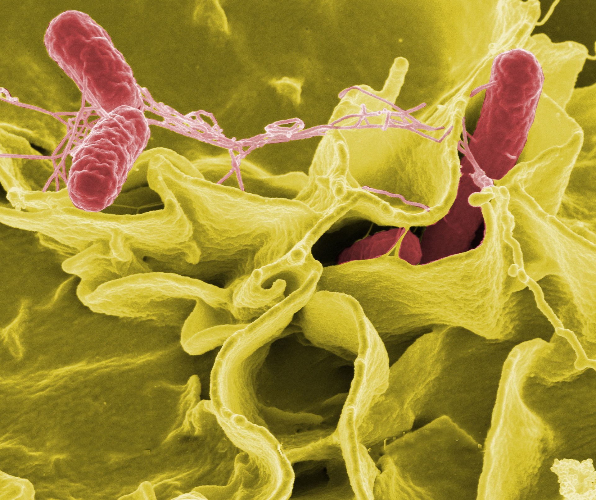 understanding-food-poisoning-food-sources-how-to-treat-causes-and-more-052038 understanding-food-poisoning-food-sources-how-to-treat-causes-and-more-052038