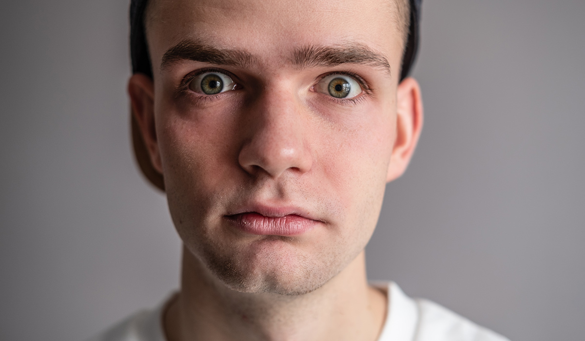 Graves’ Disease