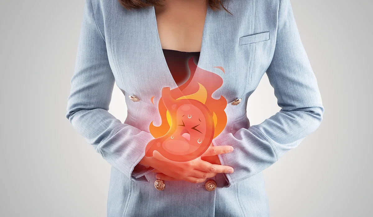 Acid Reflux