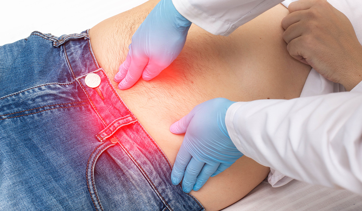 Hernia