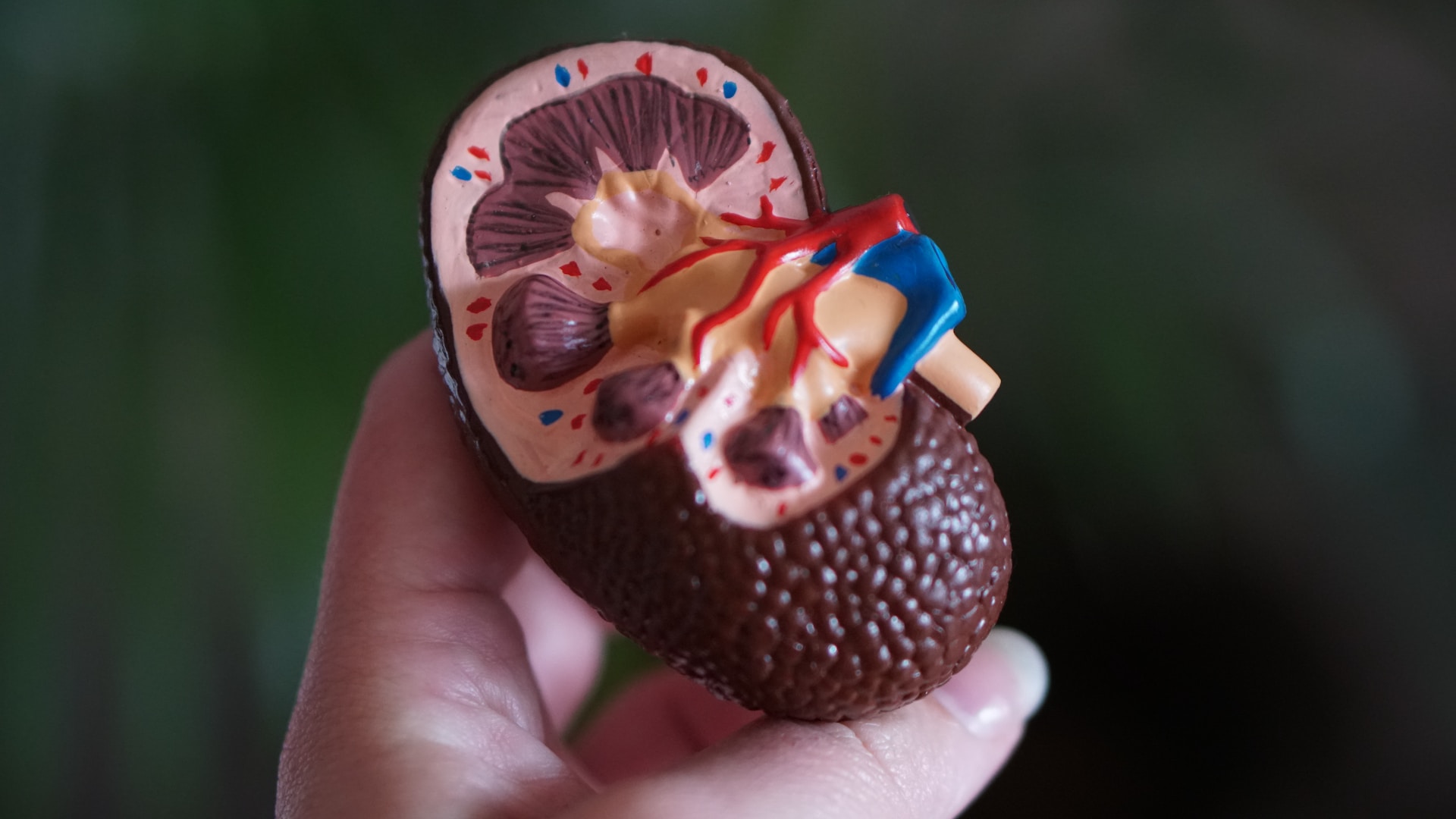 kidney-stones-696288