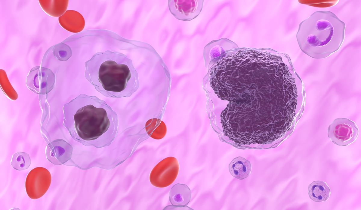 Lymphoma