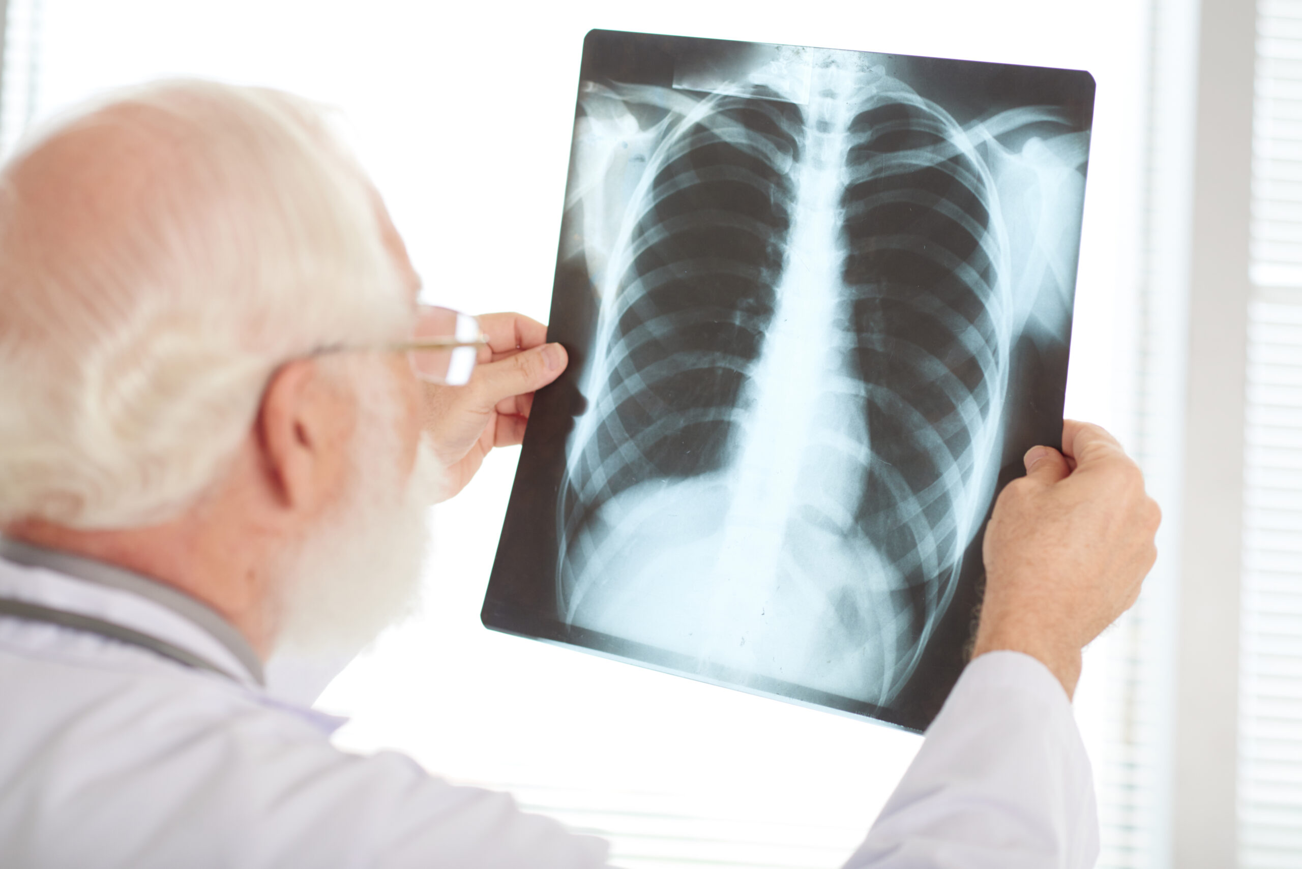 Checking x-ray Checking x-ray