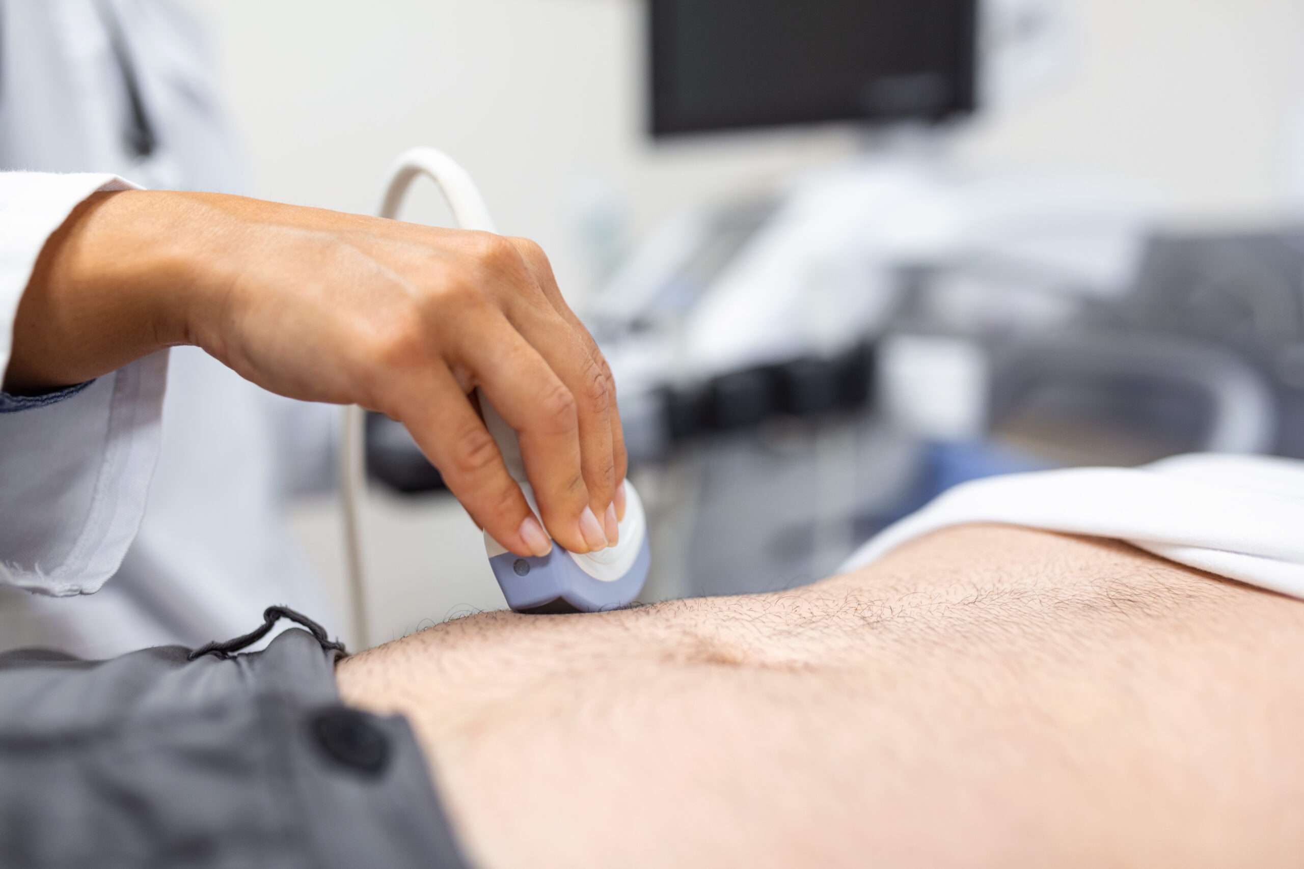 Ultrasound diagnosis of the stomach on the abdominal cavity of a man in the clinic, close-up view. The doctor runs an ultrasound sensor over the patient’s male abdomen. Diagnostics of internal organs. Ultrasound diagnosis of the stomach on the abdominal cavity of a man in the clinic, close-up view. The doctor runs an ultrasound sensor over the patient’s male abdomen. Diagnostics of internal organs.