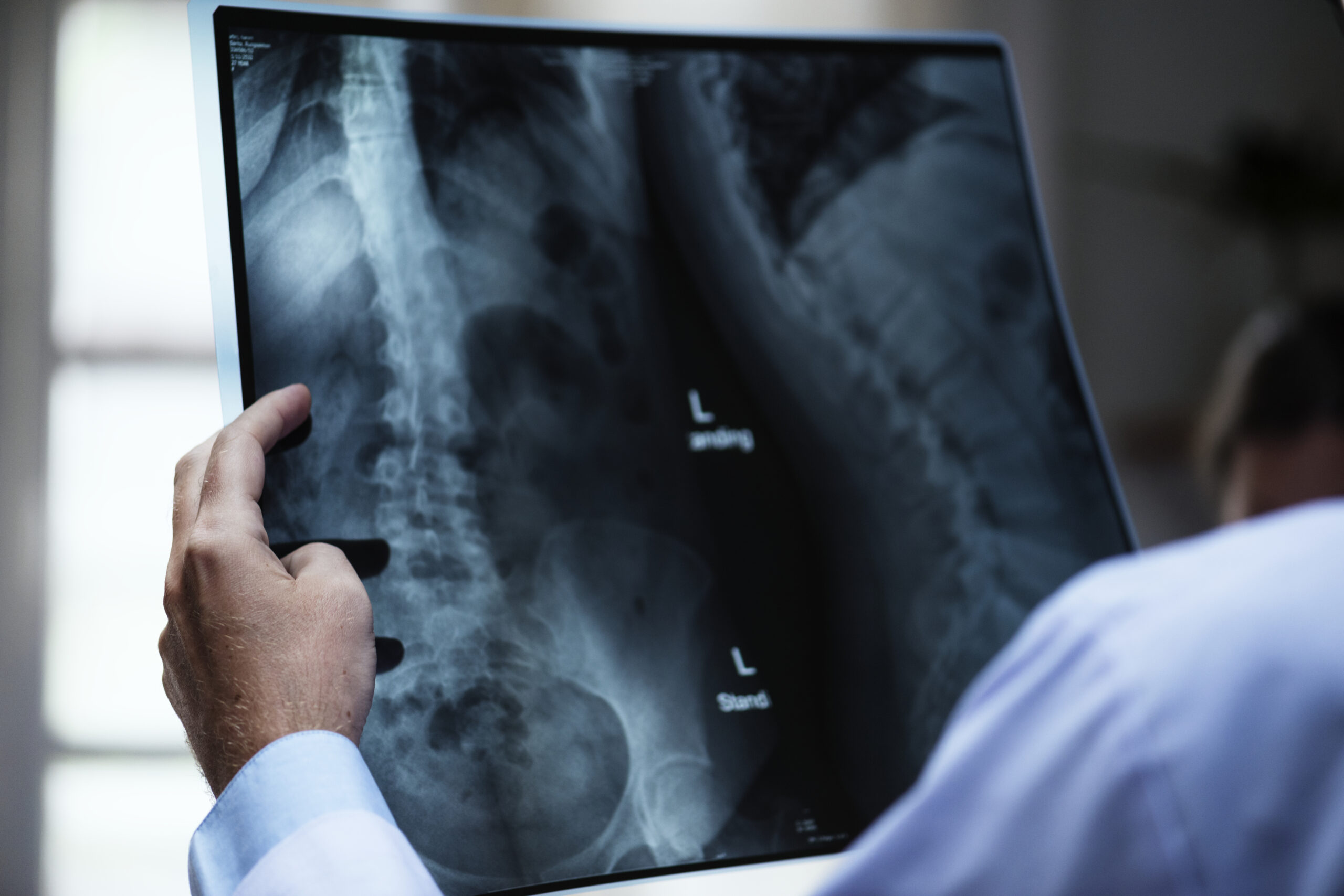 A doctor with a patient’s x-ray film A doctor with a patient’s x-ray film