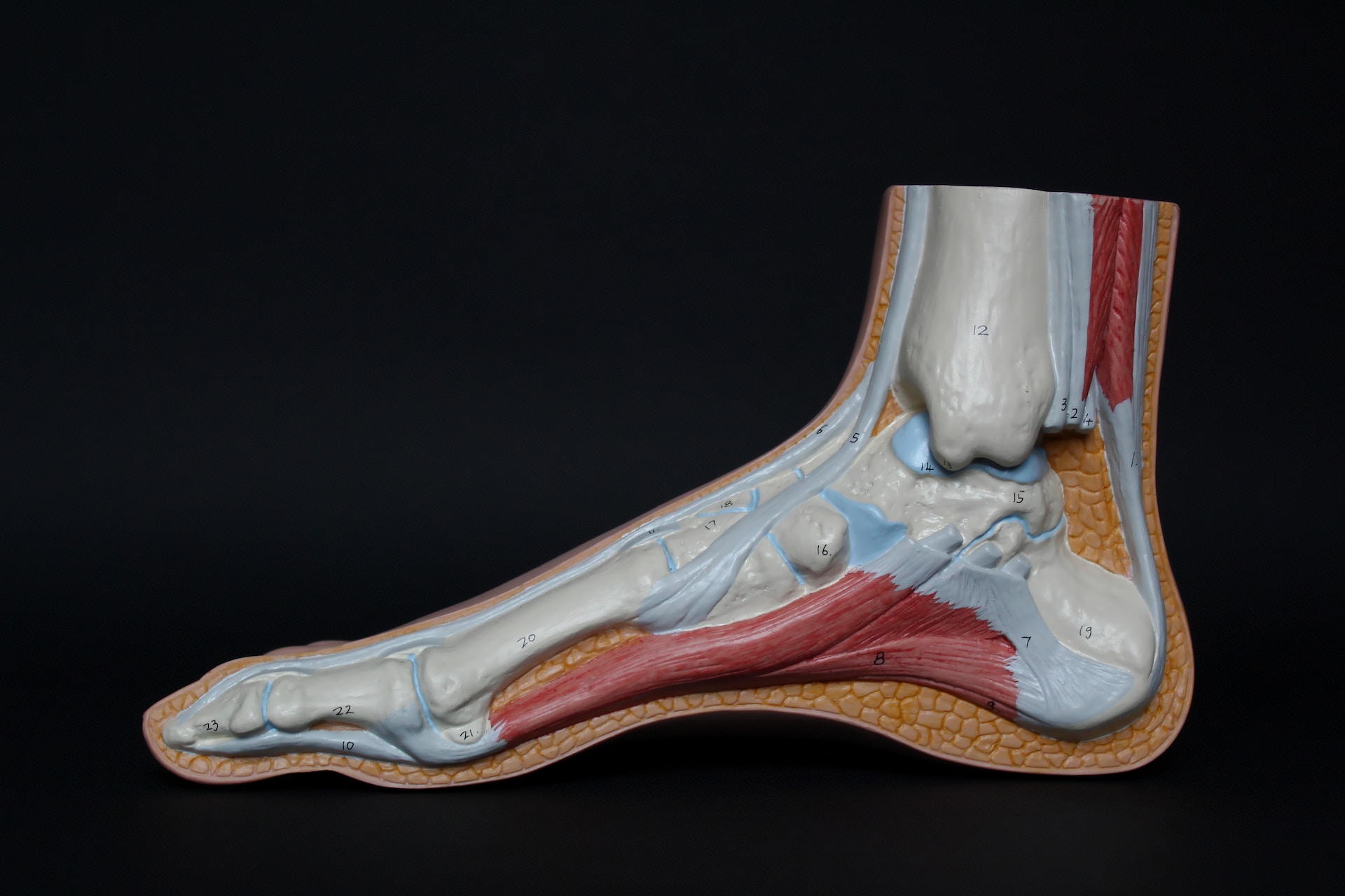 mortons-neuroma-175157