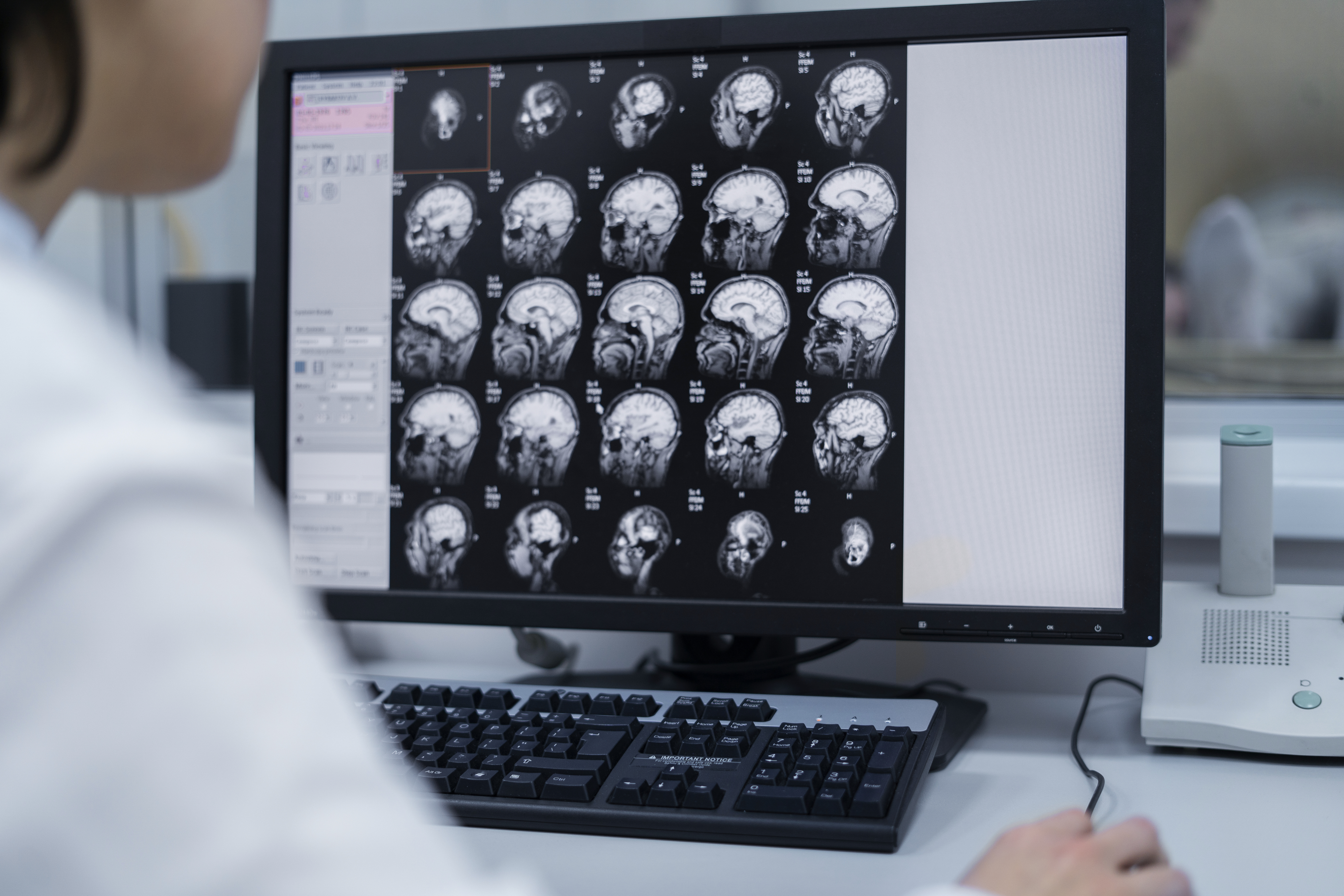 vertigo-what-is-causes-symptoms-diagnosis-amp-effective-treatment-340880 vertigo-what-is-causes-symptoms-diagnosis-amp-effective-treatment-340880