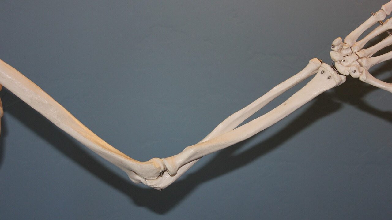tennis-elbow-433591 tennis-elbow-433591
