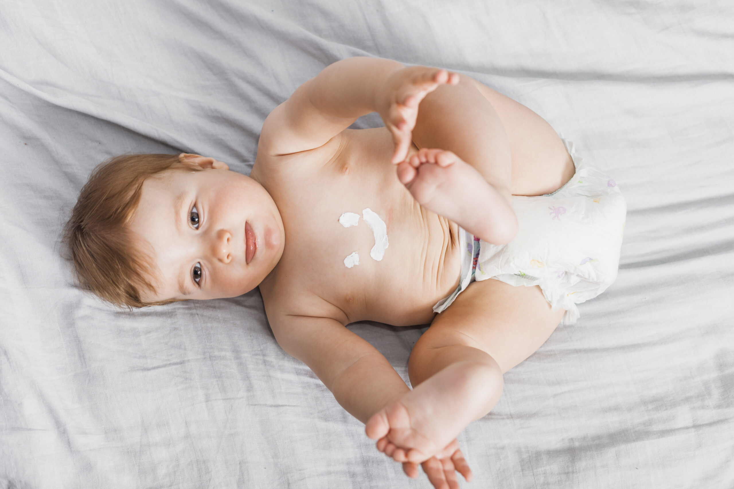 heat-rash-what-is-symptoms-types-amp-causes-864148 heat-rash-what-is-symptoms-types-amp-causes-864148