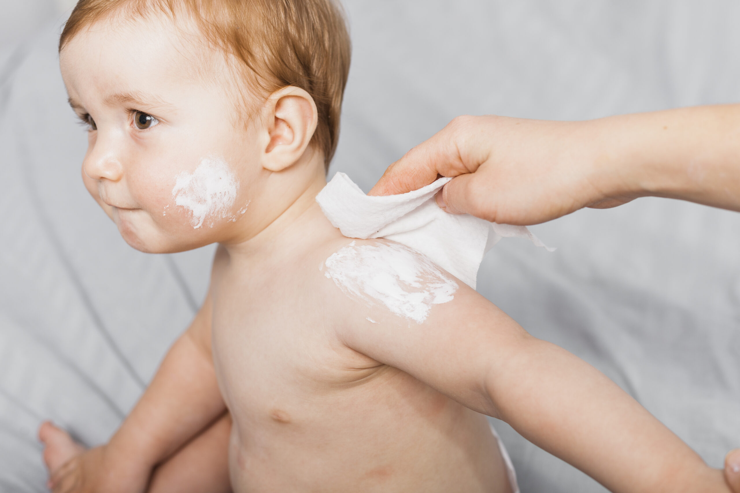 heat-rash-what-is-symptoms-types-amp-causes-990572 heat-rash-what-is-symptoms-types-amp-causes-990572