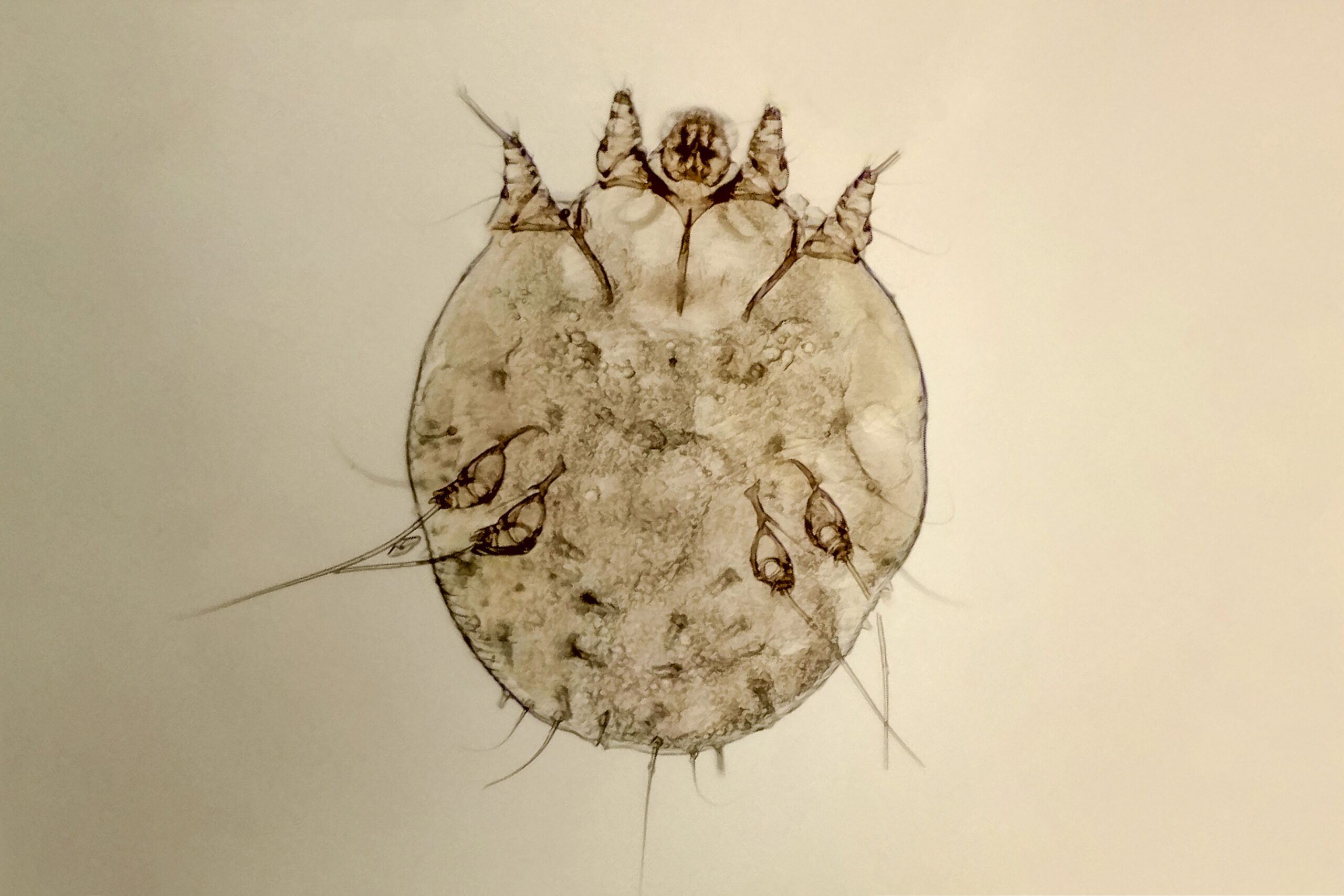 Itch-mite,,Parasitic,Microorganism,Of,Human,Skin,,Microscope,View Itch-mite,,Parasitic,Microorganism,Of,Human,Skin,,Microscope,View