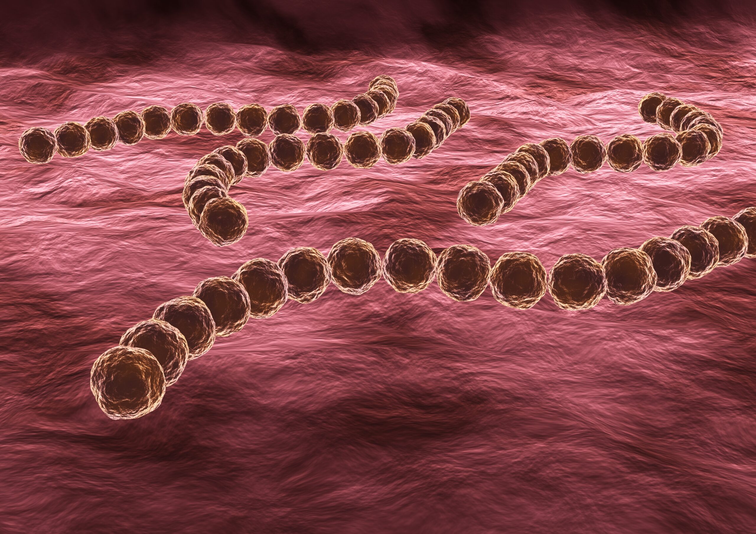 Streptococcus,Pyogenes,Is,A,Highly,Infectious,Pathogenic,Bacterium,,It,Can Streptococcus,Pyogenes,Is,A,Highly,Infectious,Pathogenic,Bacterium,,It,Can