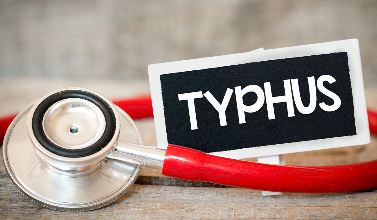 Typhus