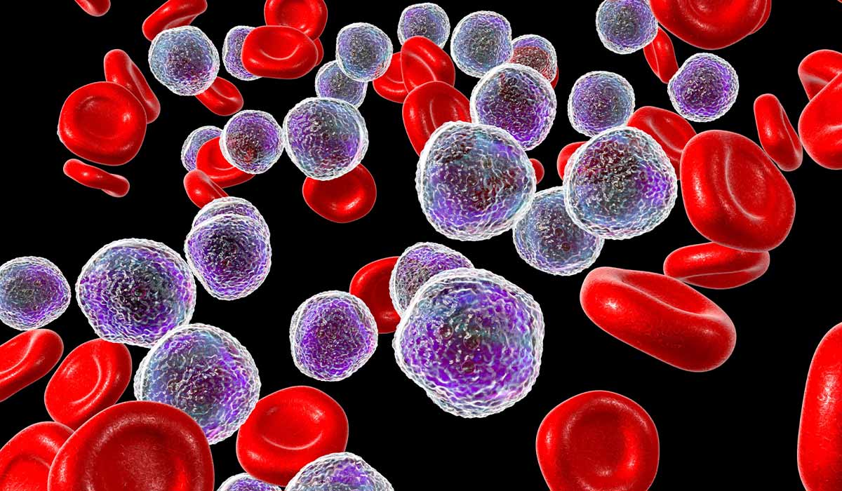 Leukemia