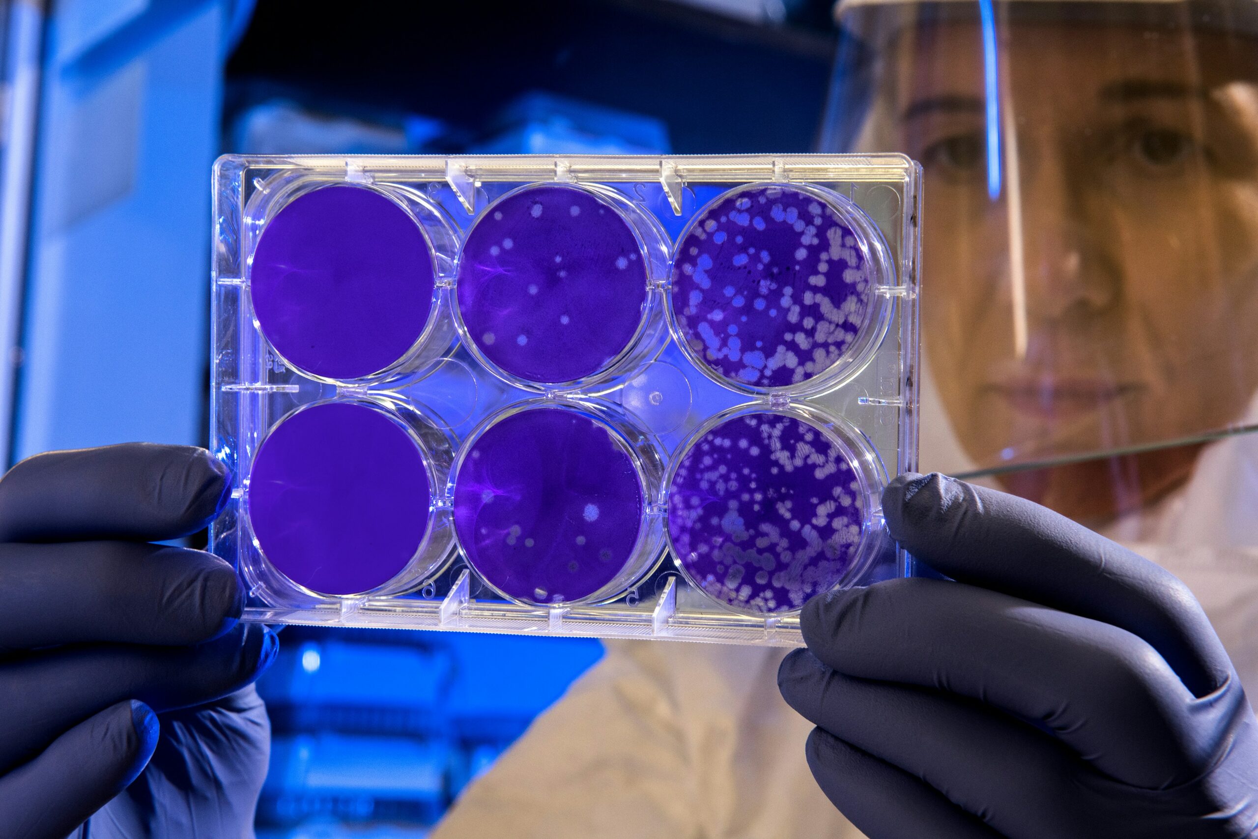 neutrophils-what-is-roles-levels-testing-and-treatment-130675 neutrophils-what-is-roles-levels-testing-and-treatment-130675