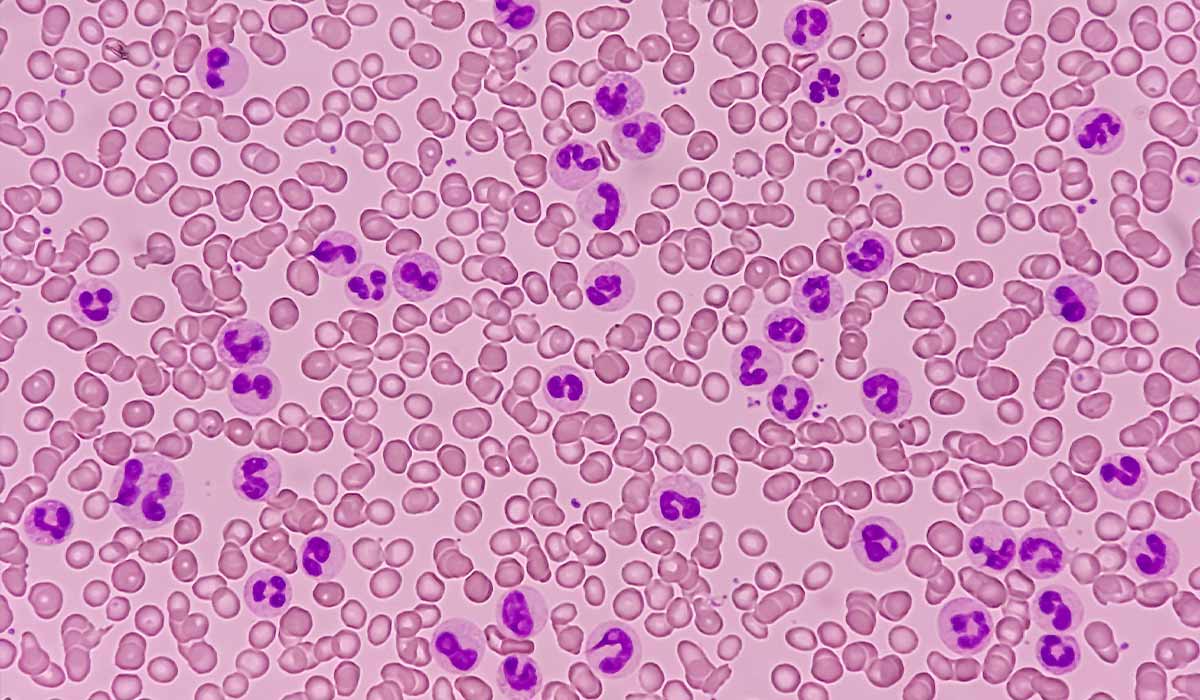 Neutrophils