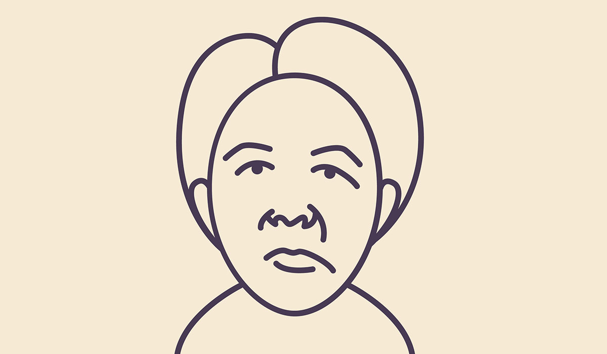 Bell’s Palsy