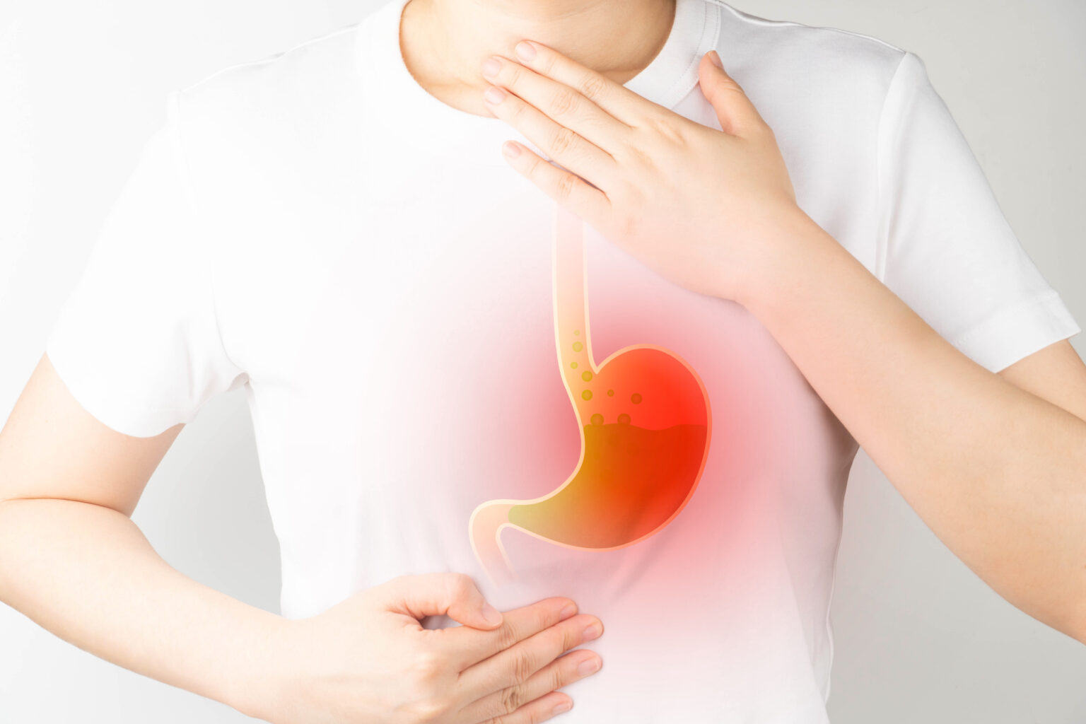 Gastroesophageal,Reflux,Disease,(gerd),Or,Acid,Reflux,Symptoms.,Woman,Suffering