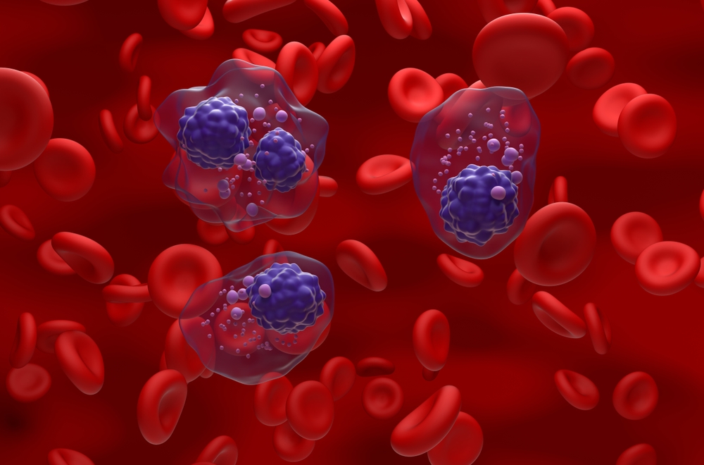 Multiple,Myeloma,Cells,Cluster,In,The,Blood,Flow,-,Isometric Multiple,Myeloma,Cells,Cluster,In,The,Blood,Flow,-,Isometric
