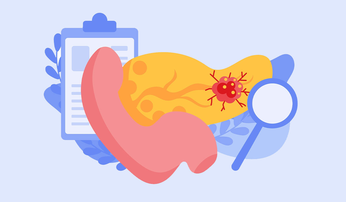 Pancreatitis