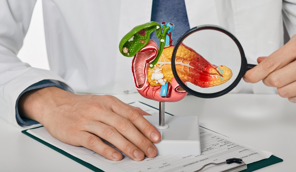 Diagnosis,And,Treatment,Of,Pancreatic,Disease.,Doctor,Consulting,Patient,With Diagnosis,And,Treatment,Of,Pancreatic,Disease.,Doctor,Consulting,Patient,With