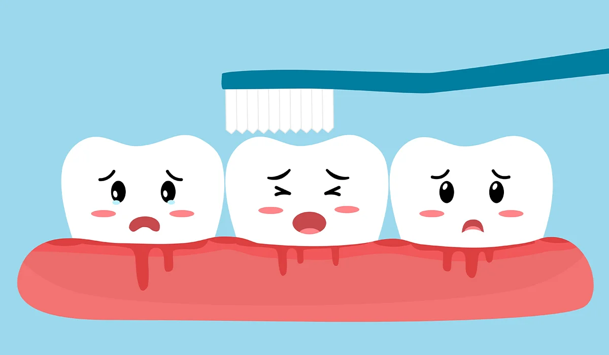 Gingivitis