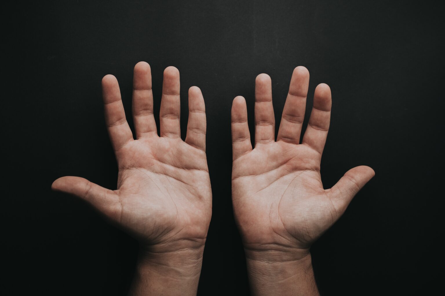 hyperhidrosis-what-is-types-causes-symptoms-and-diagnosis-534952 hyperhidrosis-what-is-types-causes-symptoms-and-diagnosis-534952