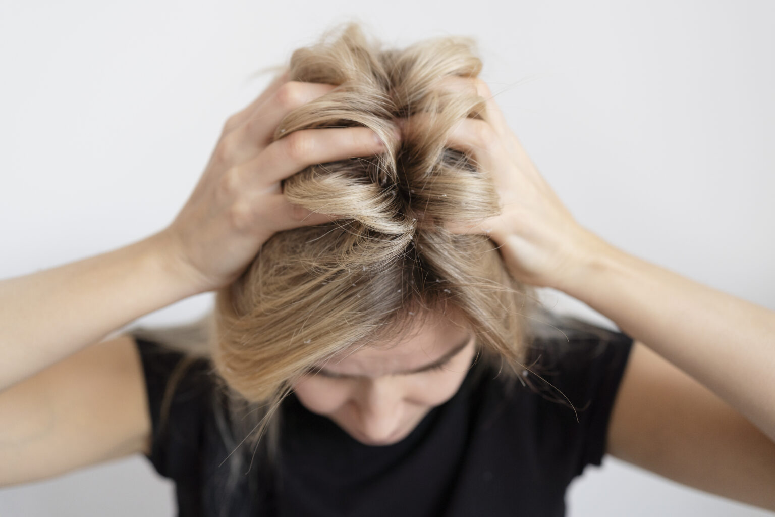 itchy-scalp-what-is-causes-amp-effective-treatment-765785 itchy-scalp-what-is-causes-amp-effective-treatment-765785
