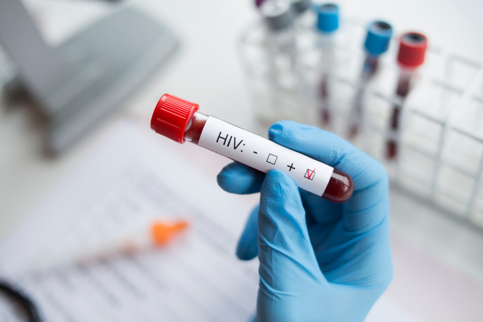 Diagnostician,Holding,In,Hand,A,Positive,Hiv,Test. Diagnostician,Holding,In,Hand,A,Positive,Hiv,Test.