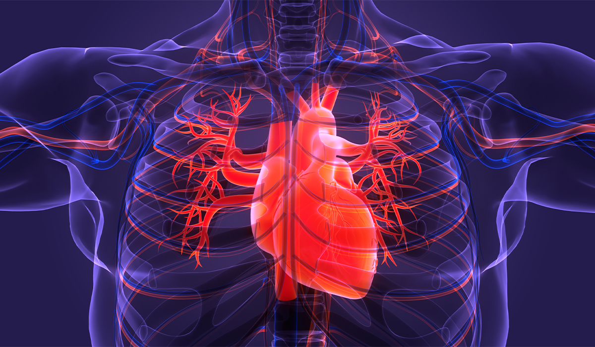 Angina