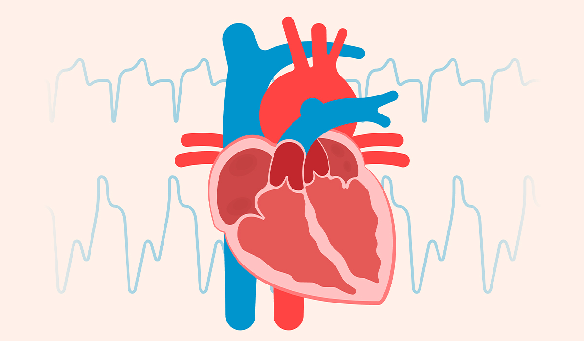 Cardiomyopathy: What Is, Types, Causes, Symptoms, Diagnosis, and Treatment