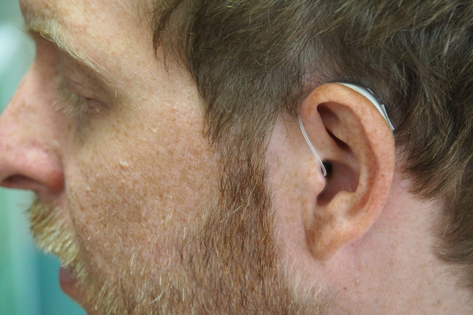 ear-infection-what-is-types-causes-symptoms-diagnosis-and-treatment-496337 ear-infection-what-is-types-causes-symptoms-diagnosis-and-treatment-496337