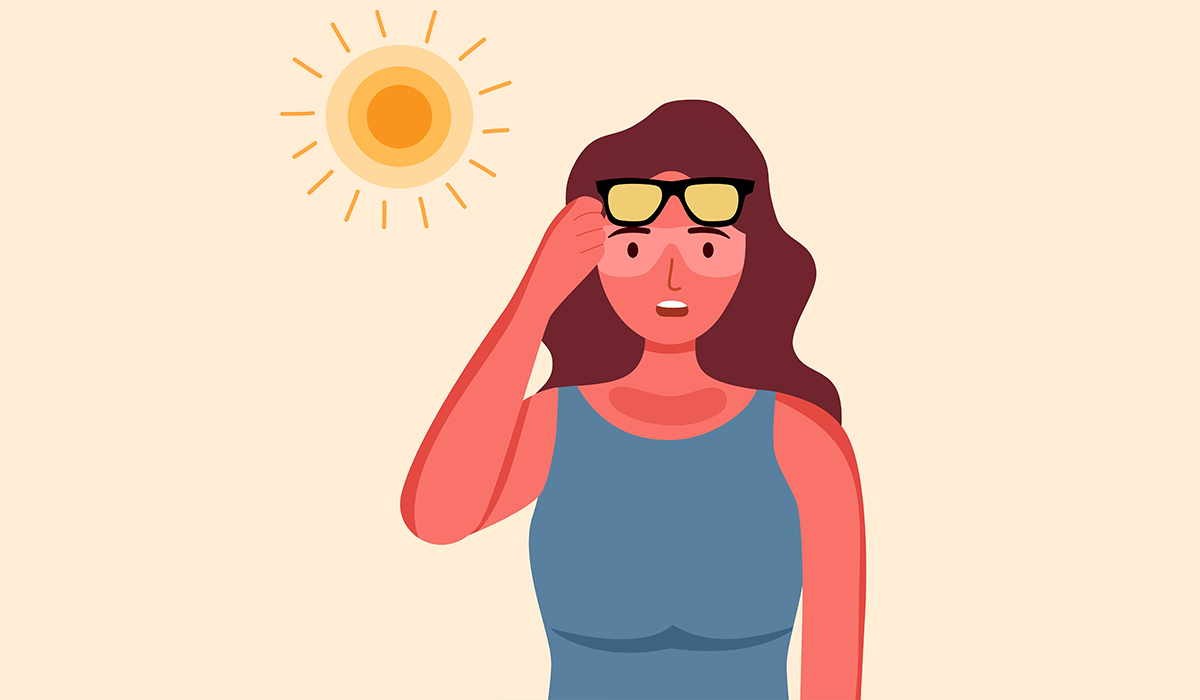Sunburn