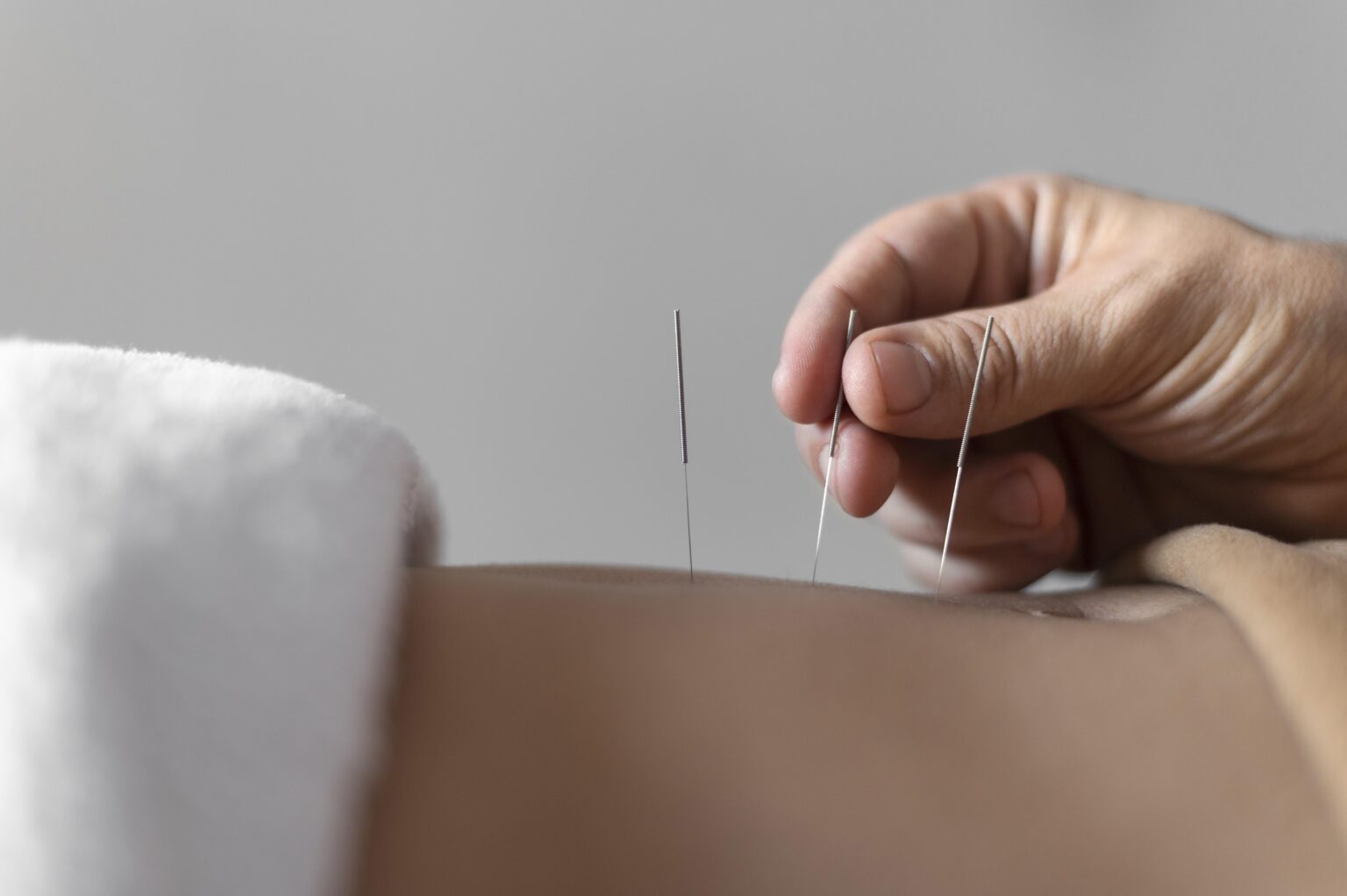 acupuncture-what-is-mechanism-of-action-risks-343786 acupuncture-what-is-mechanism-of-action-risks-343786
