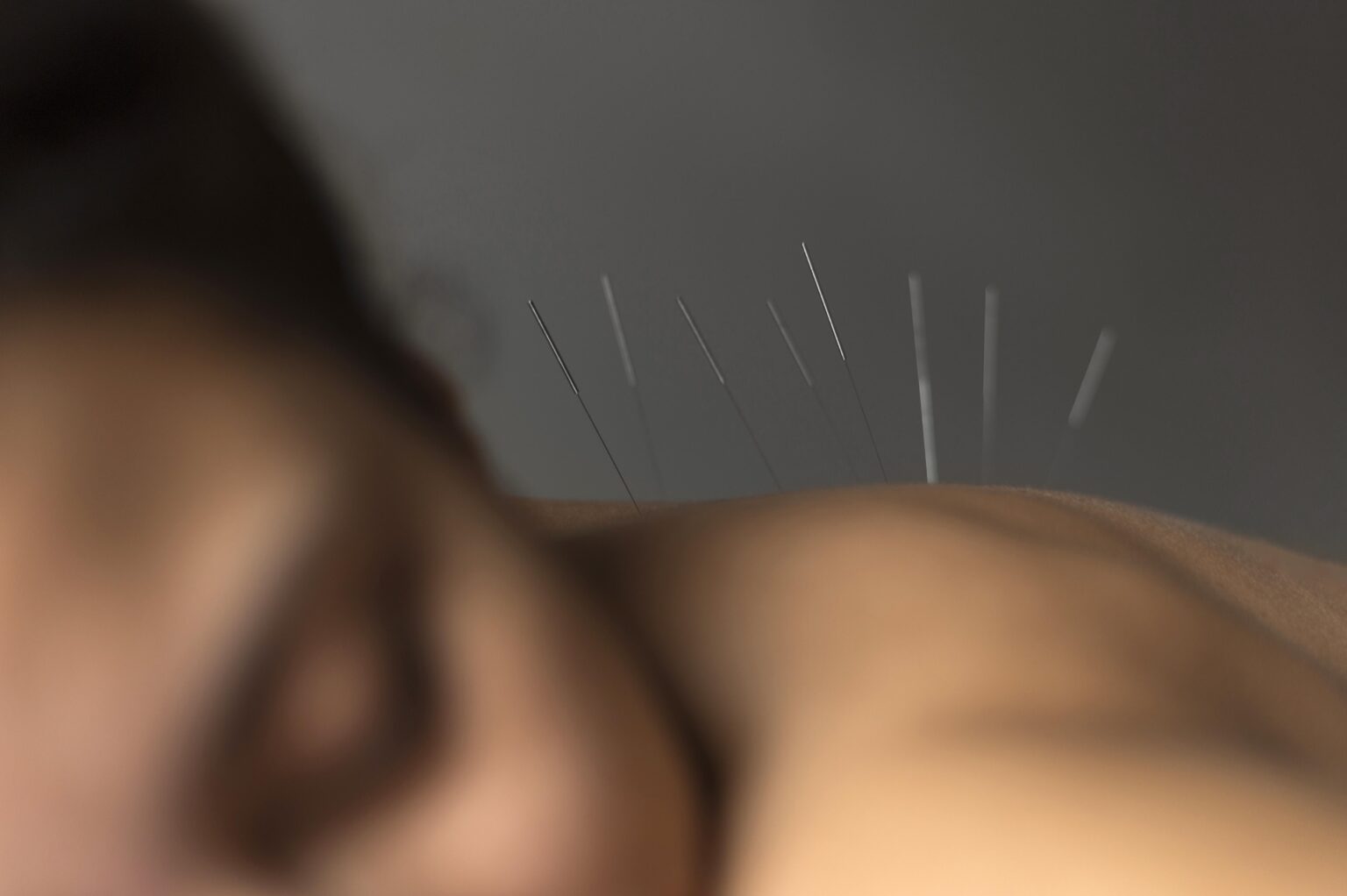 acupuncture-what-is-mechanism-of-action-risks-752128 acupuncture-what-is-mechanism-of-action-risks-752128
