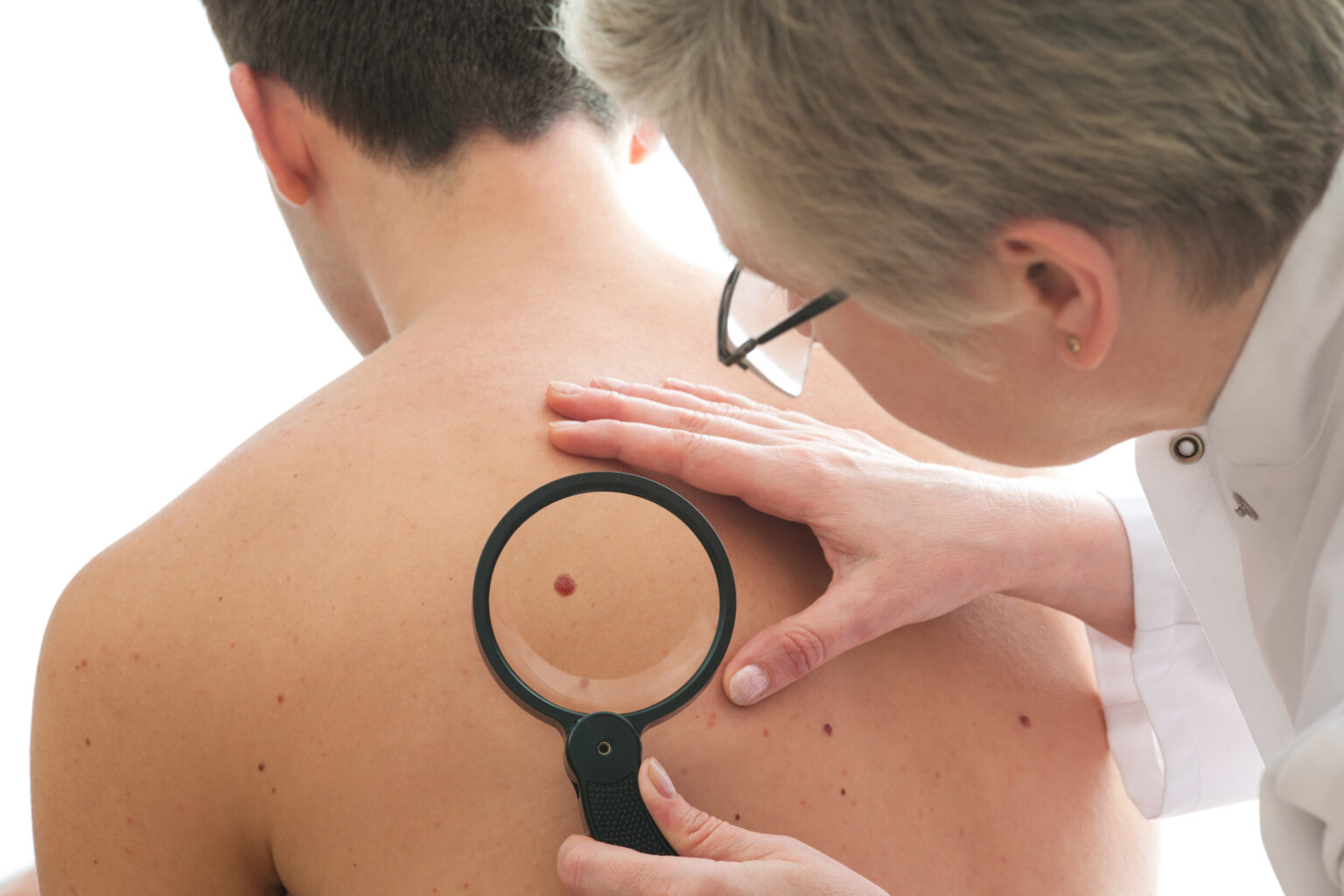 Dermatologist,Examines,A,Mole,Of,Male,Patient Dermatologist,Examines,A,Mole,Of,Male,Patient