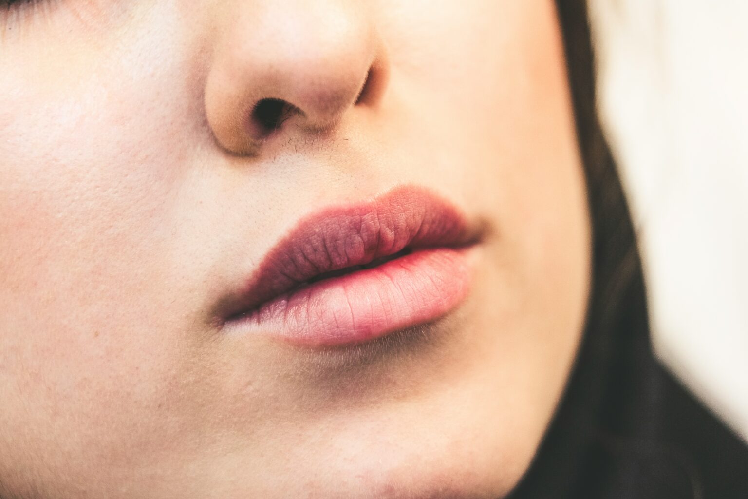 chapped-lips-550077