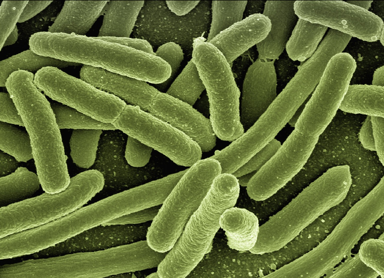 cholera-what-is-causes-symptoms-diagnosis-364712 cholera-what-is-causes-symptoms-diagnosis-364712