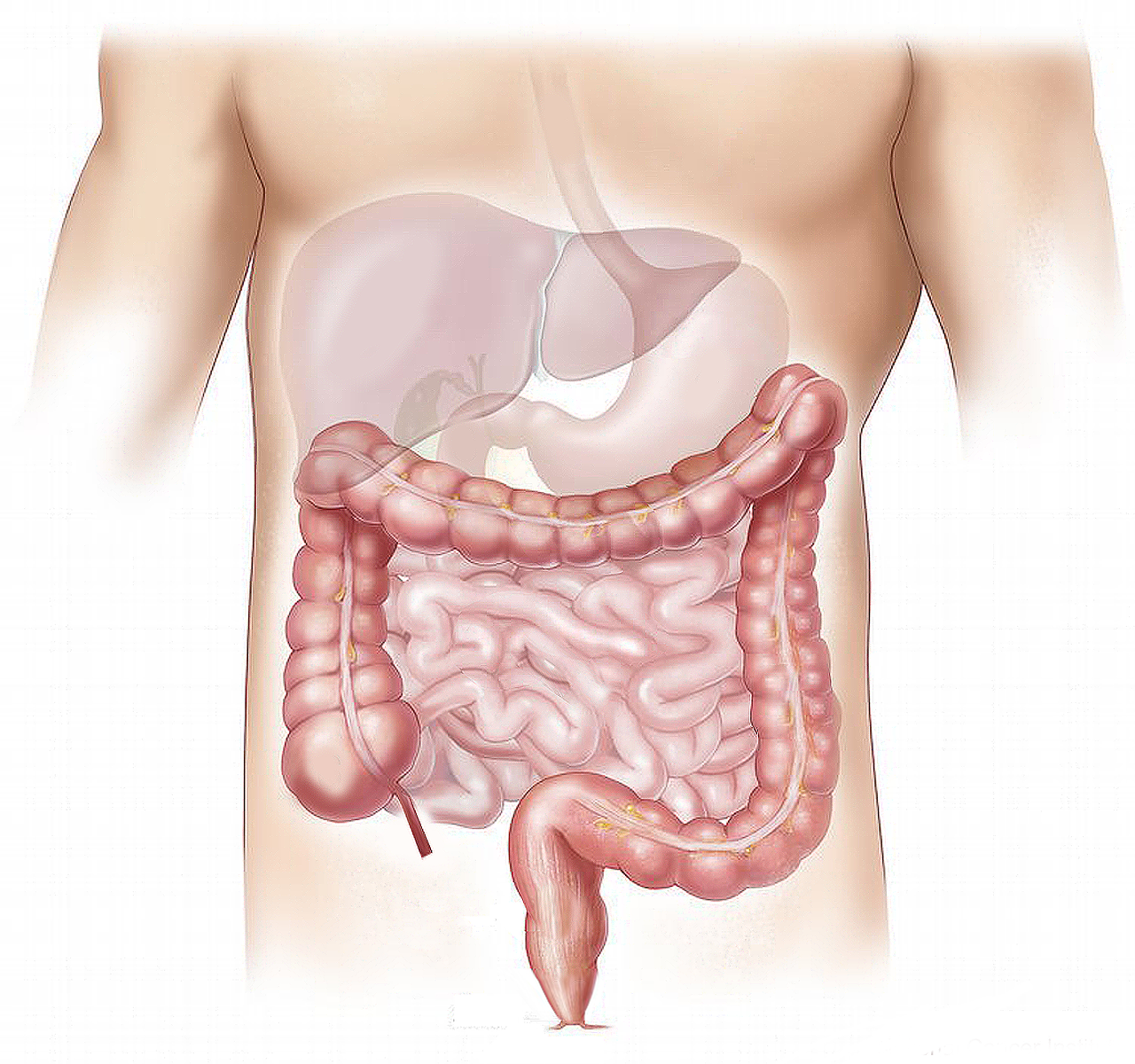 colon-cancer-risk-factors-symptoms-diagnosis-and-treatment-730963 colon-cancer-risk-factors-symptoms-diagnosis-and-treatment-730963