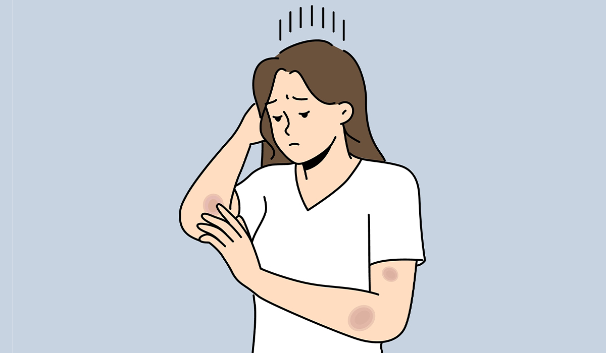 Hematoma