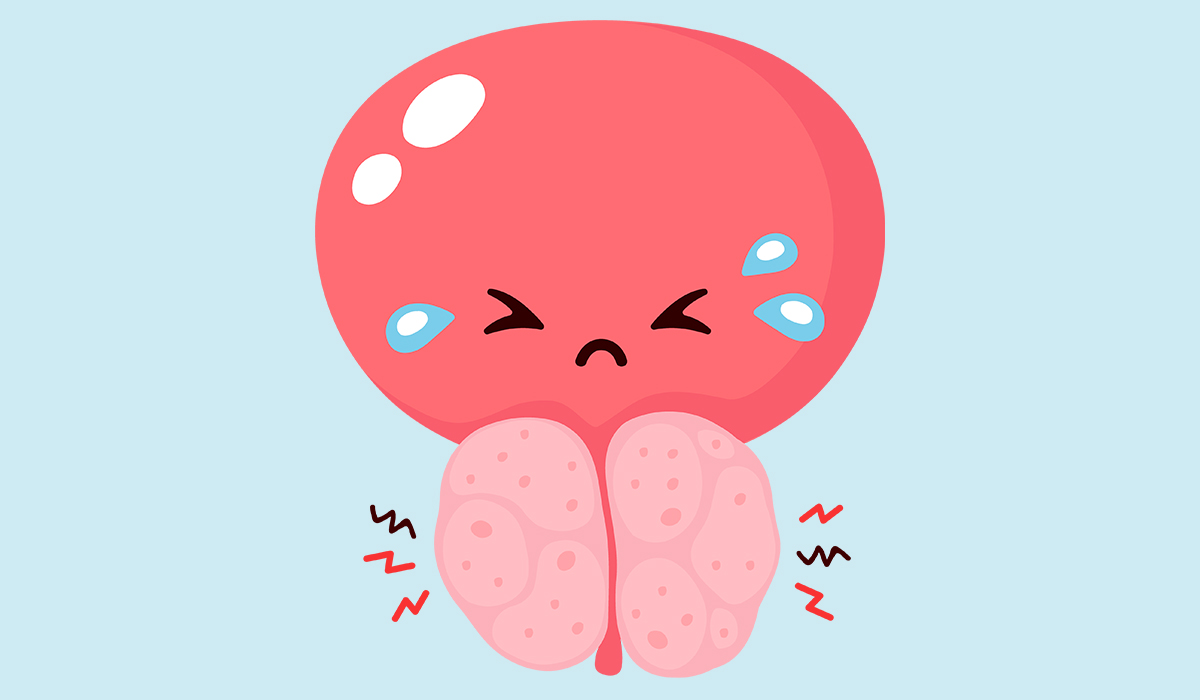 Prostatitis